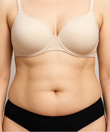 Antes da criolipólise abdominal