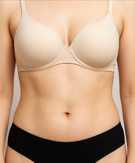 Depois da criolipólise abdominal